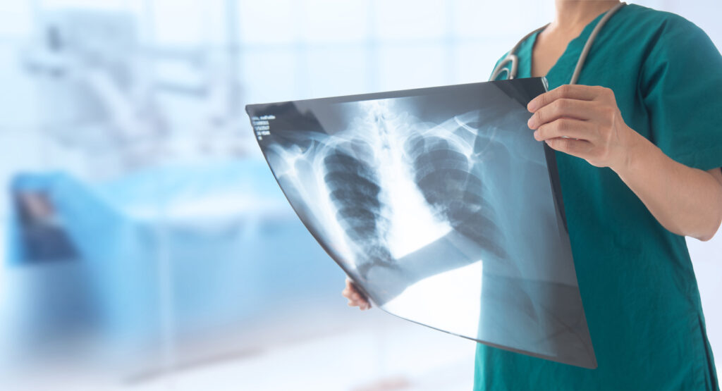 lung x-ray Radiologic Technologists - Diaserv